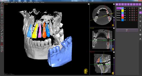 dicom to stl converter software.